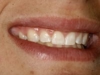 Konig Center for Cosmetic & Comprehensive Dentistry smile photos